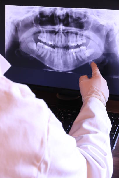 Best Emergency Dental Care for Broken or Chipped Teeth in Rugby, ND