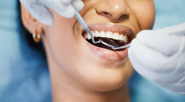 Best Emergency Dental Care for Broken or Chipped Teeth in Rugby, ND